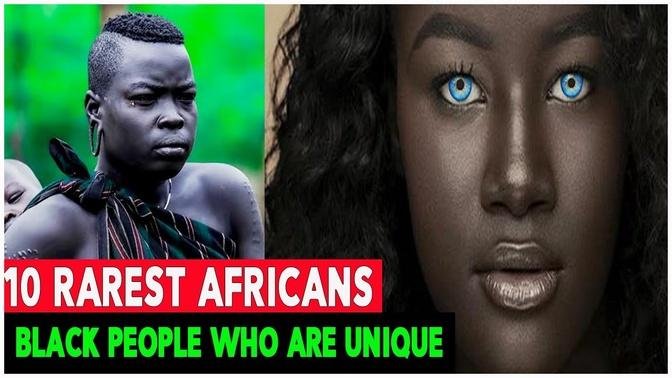 10 Rarest Africans, Black People Who Are Unique.