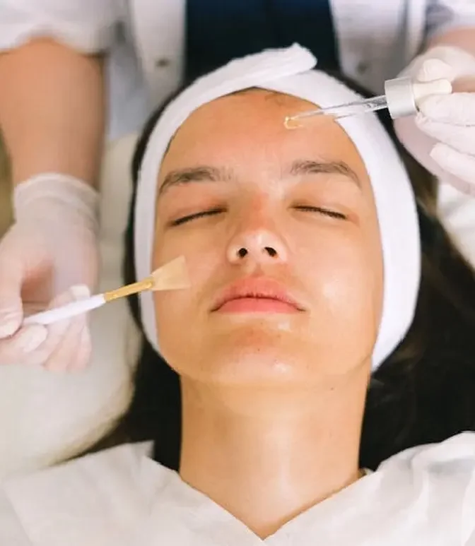 "Skin Harmony: Superficial Chemical Peels and You"