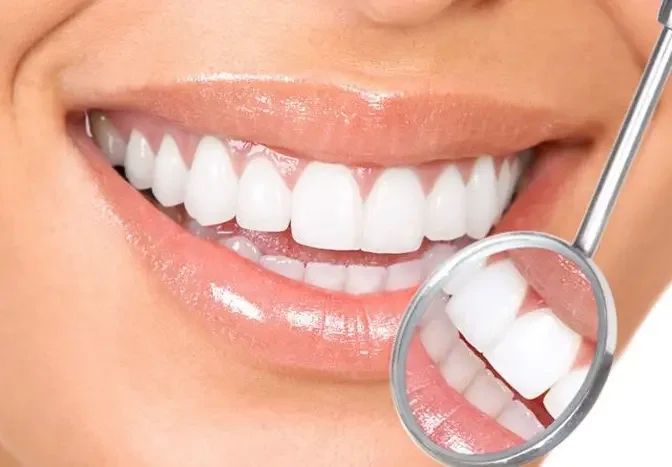 Smiling Bright in Dubai: How Much Do Tooth Fillings Cost?