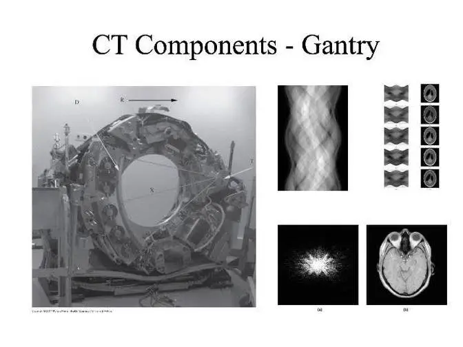 Radiation Therapy Simulator Design