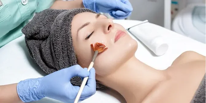 "A New Dawn for Your Skin: Superficial Chemical Peels Unveiled"