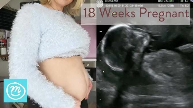 cruise 18 weeks pregnant