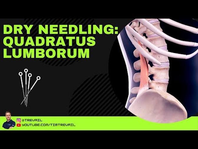 Dry Needling: Quadratus Lumborum