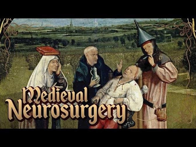 Middle Ages Surgery: History of Neurosurgery