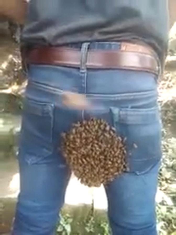 That shouldn't BEE there!' Man in east India has insect hive stuck to his behind