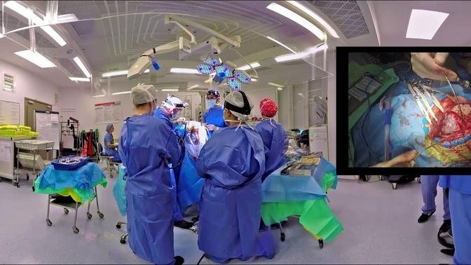 VR Surgery - Brain aneurysm