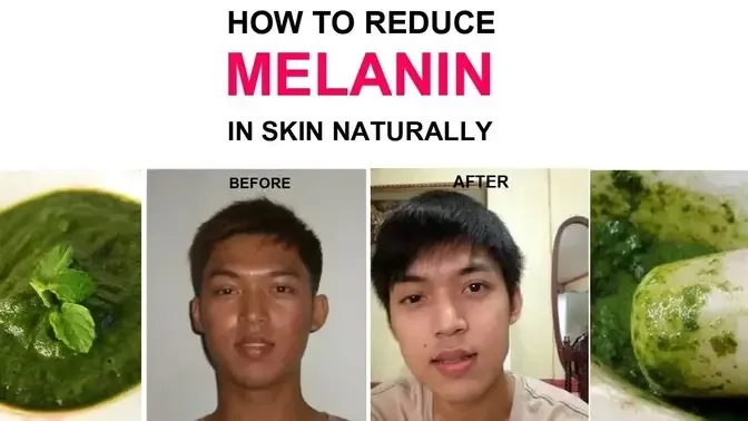 How to reduce melanin in skin naturally ｜ How to reduce melanin in face ｜ Get fair with no Money