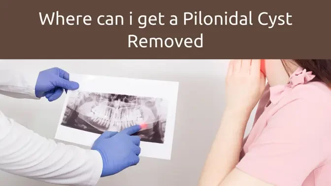 Comparing Surgical Techniques: Knowing the Best Solution for Your Pilonidal Cyst