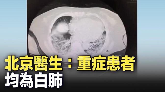 北京醫生：重症患者肺部感染變白肺